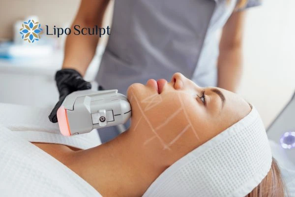 HIFU vs Botulinum Toxin: Understanding the Differences 1 HIFU vs Botox Whitley Bay What is the best option for you?