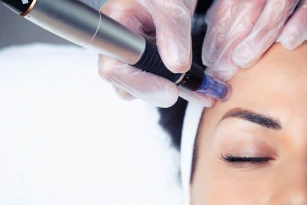 Explaining Total Skin Tightening Treatment and What to Expect 2 What Skin Concerns Can Total Skin Tightening Treatment Help With Whitley Bay?